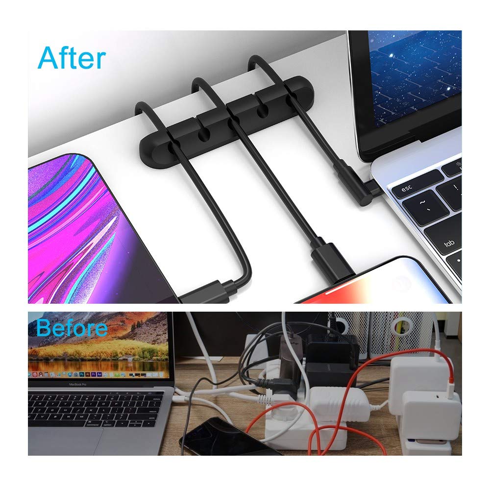 Forlipo Cable Clips