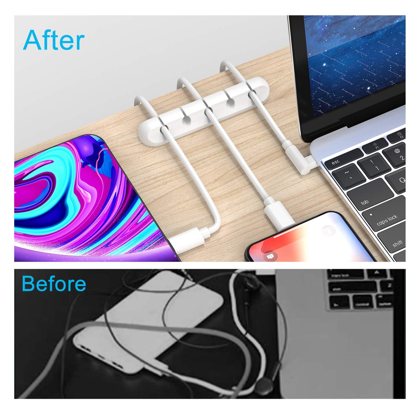 Forlipo Cable Clips